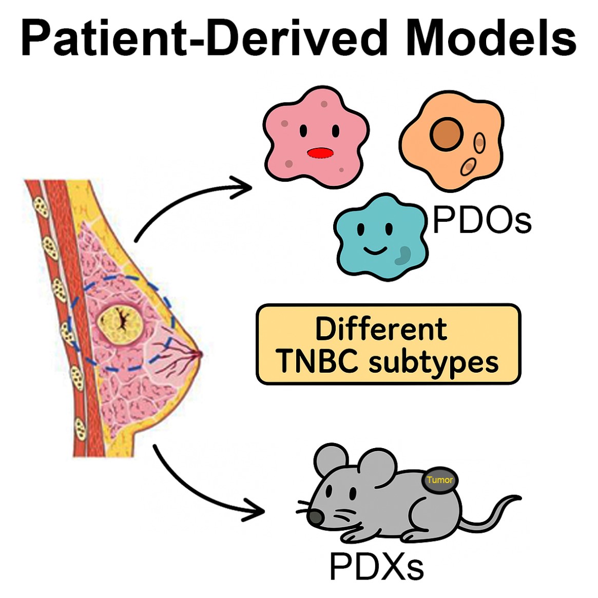 TNBC4